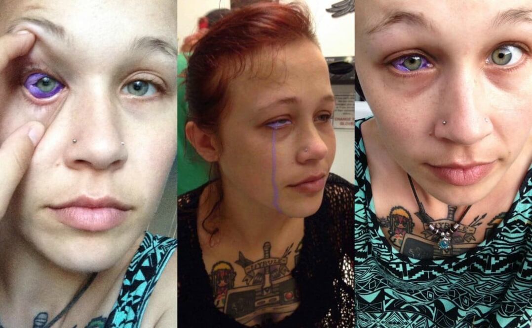 Por querer innovar con un dibujo en el ojo, esta modelo podría quedar ciega. (Foto: Facebook)