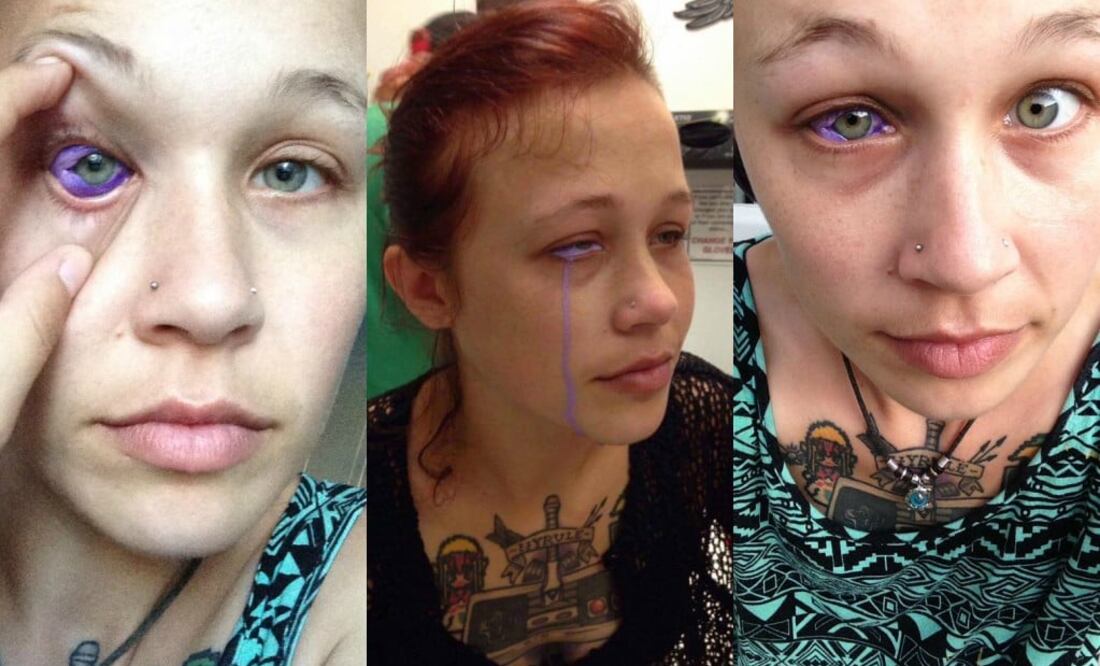 Por querer innovar con un dibujo en el ojo, esta modelo podría quedar ciega. (Foto: Facebook)