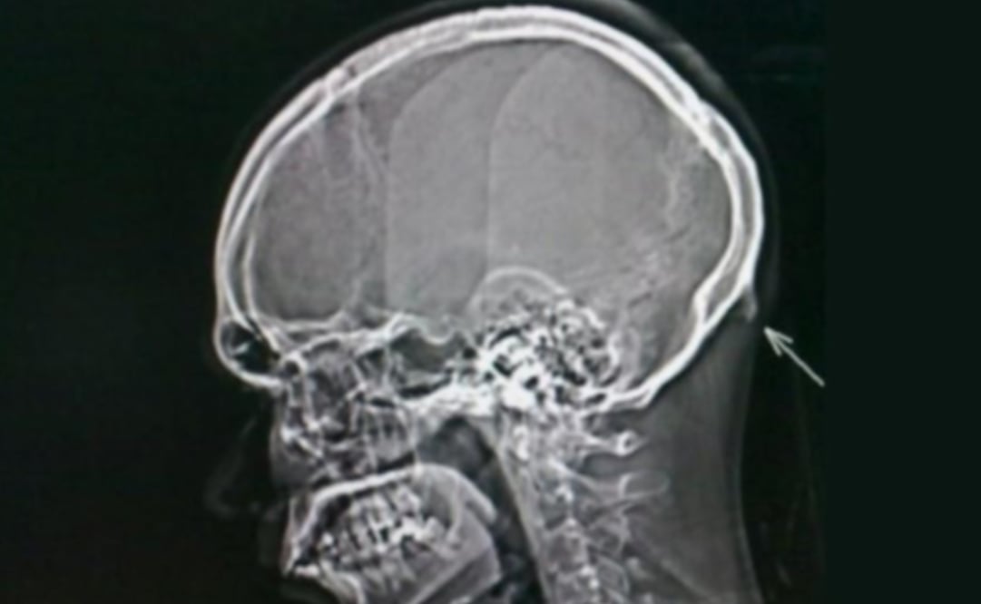 Los científicos alertaron sobre las consecuencias que trae el uso excesivo del teléfono celular