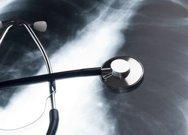 Esta técnica permitirá rehabilitar pulmones dañados