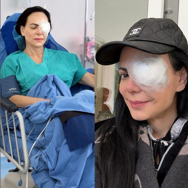 Maribel Guardia, de 65 años, se somete a cirugía ocular.