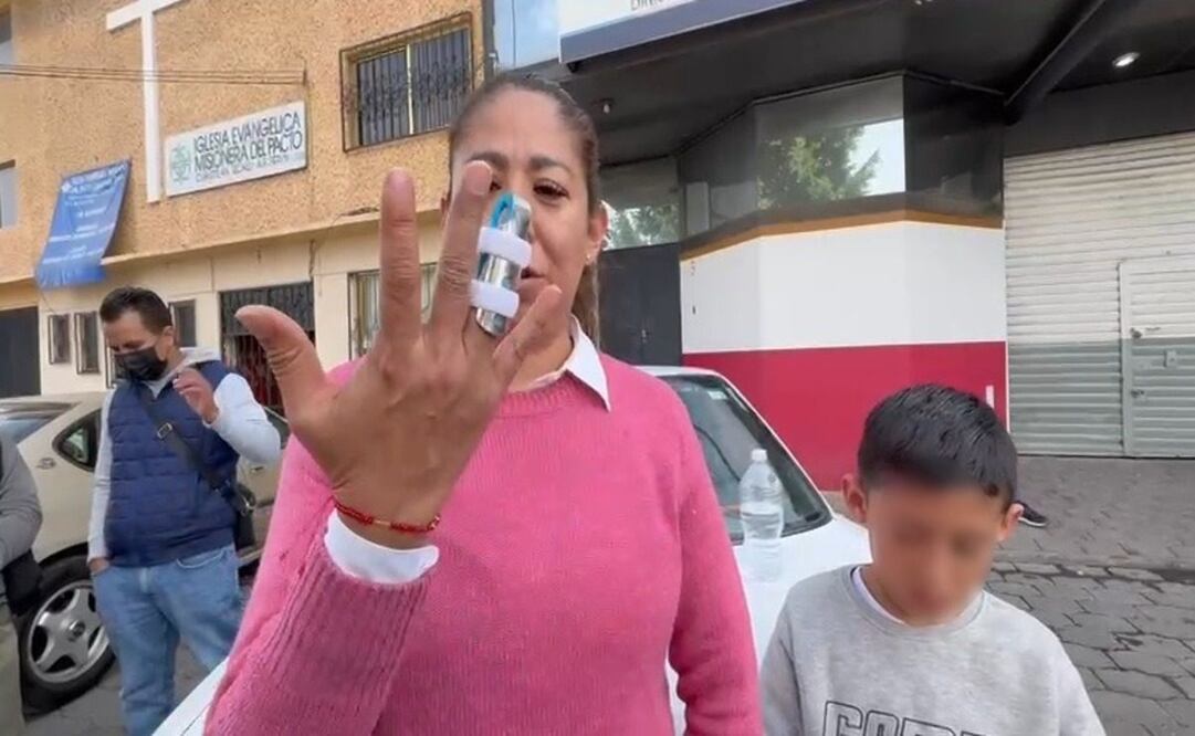 Vecinos de Tultitlan denuncian agresiones policiales por protestas (08/01/2025). Foto: Arturo Contreras / EL UNIVERSAL
