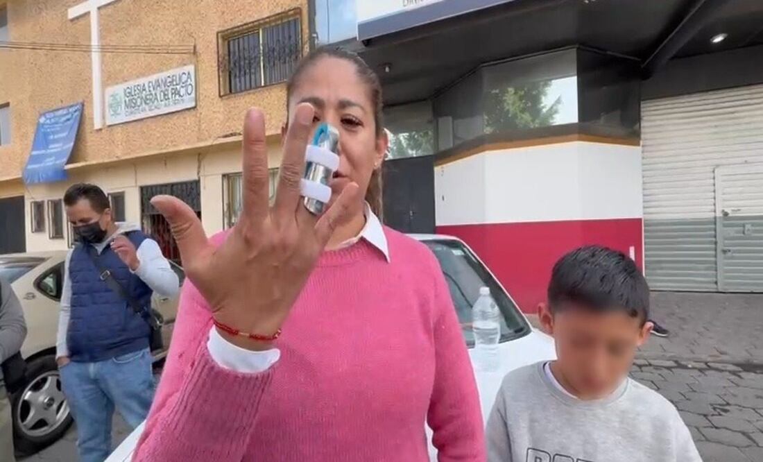 Vecinos de Tultitlan denuncian agresiones policiales por protestas (08/01/2025). Foto: Arturo Contreras / EL UNIVERSAL