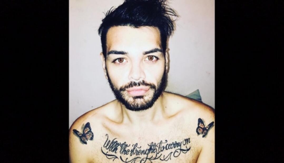 El hombre que se operó más de 20 veces para parecerse a Ricky Martin