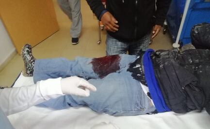 Hieren a religiosa mientras entregaba ayuda humanitaria a desplazados en Chiapas 