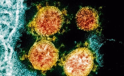 ¿Un nuevo coronavirus puede surgir en tu casa? Así buscan con Inteligencia Artificial
