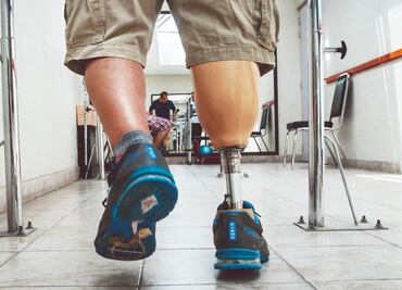 Desarrollan prótesis de pie y tobillo de bajo costo en Jalisco