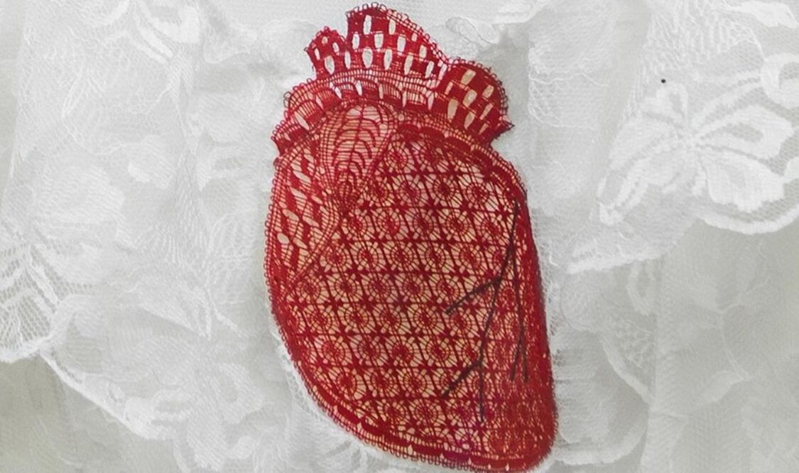 Fragmento de la obra "Sí". Foto: Instagram de MALBA 