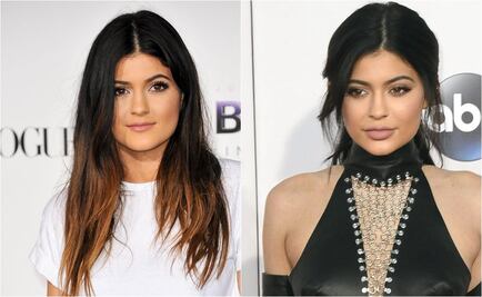¿Cómo ha transformado Kylie Jenner su rostro?