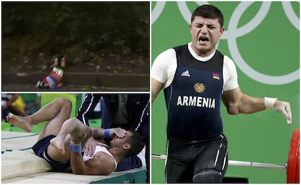 Las lesiones más dolorosas en Río 2016