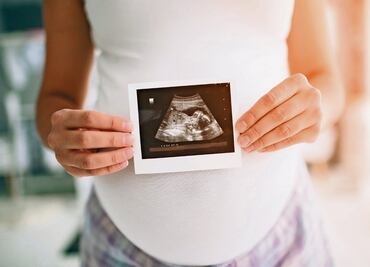 Consumo excesivo de paracetamol en el embarazo aumenta riesgo de autismo y TDAH