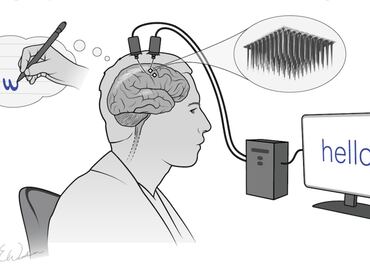 Solo lo piensas y se convierte en texto. Esperanza para personas con parálisis