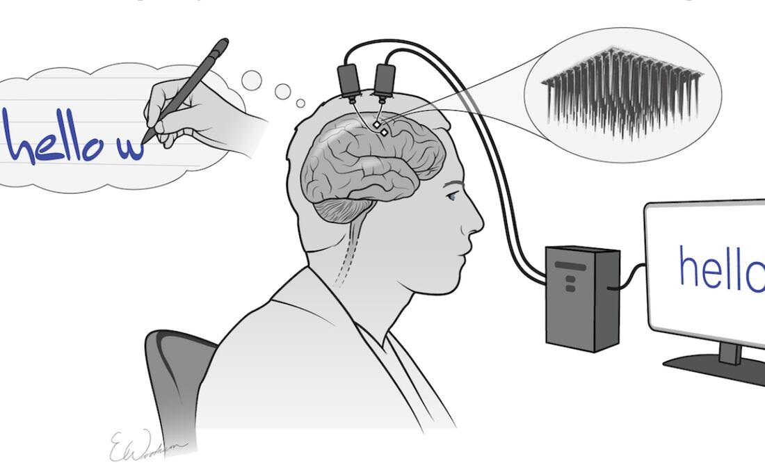 Está siendo probado por investigadores de la Universidad de Stanford.