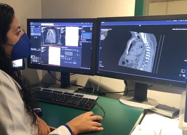 Las UMAE contribuyen a mejorar la atención de los derechohabientes del IMSS