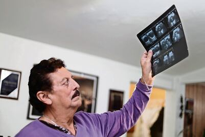 Mueren cada año 7 mil por el cáncer de próstata 