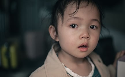 ¿Qué es el síndrome de Kabuki? Conoce sus principales síntomas 