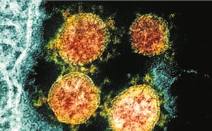 Bacterias del intestino pueden influir en gravedad del Covid-19