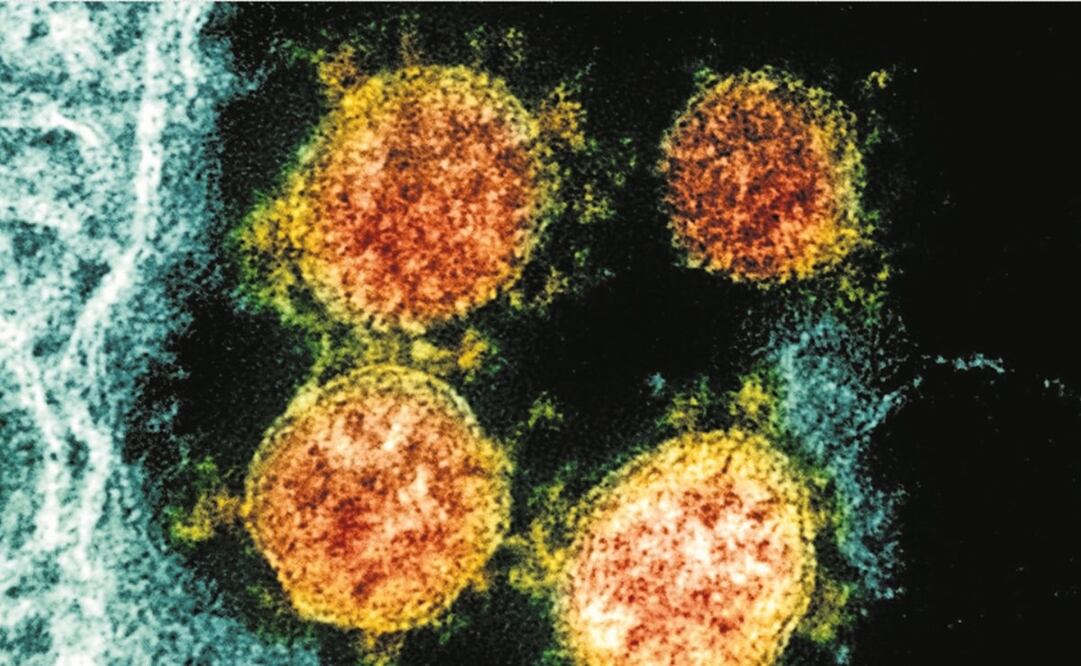 Foto: NIAID/National Institutes of Health via AP