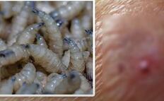 Oaxaca confirma dos casos de gusano barrenador en humanos; ambos pacientes se encuentran recuperados