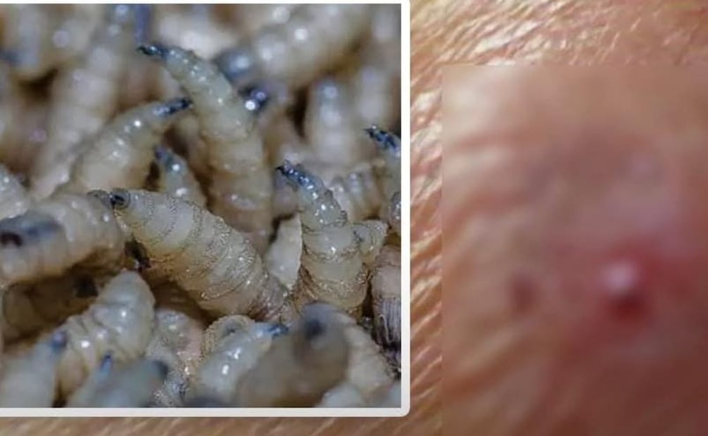 Tras el primer deceso de una persona por la miasis provocada por el gusano barrenador, la diputada local del PAN, Ana Cristina Polanco Bautista, pidió deslindar responsabilidades y reforzar la prevención.
Foto Especial