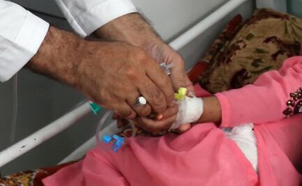 Combinación de dos virus pudo provocar casos de hepatitis infantil aguda