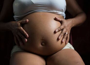 Aumentan casos de zika en mujeres embarazadas