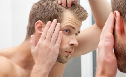 La mitad de hombres jóvenes pierden cabello por estrés y hormonas