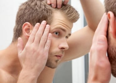 La mitad de hombres jóvenes pierden cabello por estrés y hormonas