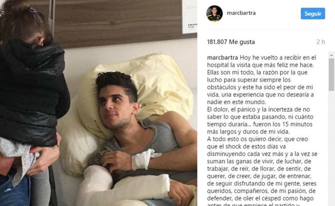 Tras ser víctima de un atentado, Bartra estará fuera de acción cuando menos un mes. Instagram