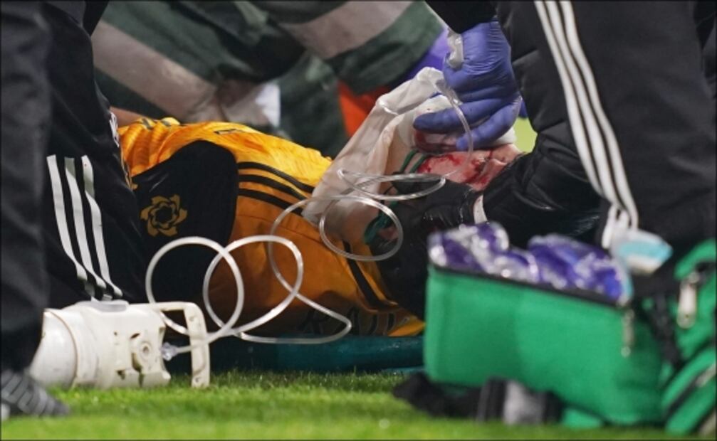 Neurólogo explica la situación de Raúl Jiménez y el tiempo en el que volvería