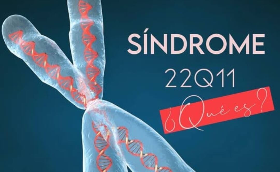 Este 22 de noviembre se conmemora el Día Internacional del Síndrome 22q11. Foto: Facebook Idaca Imagenes De Diagnostico Avanzado CA