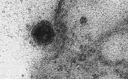 Así infecta el coronavirus a una célula