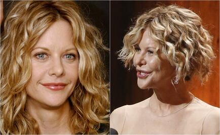 Meg Ryan impacta con su rostro