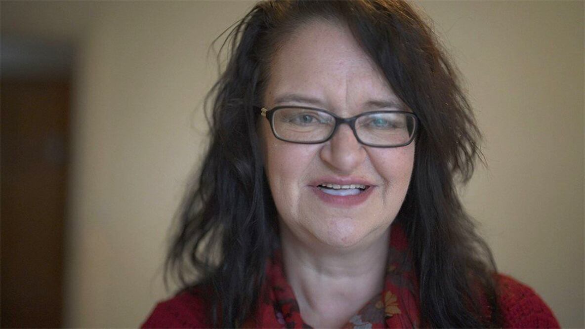 Caroline Young hace su propia dentadura en su casa, usando bolitas de plástico. Foto: BBC 