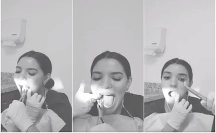 Mujer se quita las muelas del juicio sin ayuda y se vuelve viral 