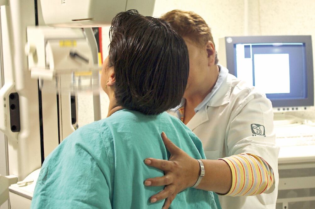 Cáncer de mama. Foto:(ARCHIVO EL UNIVERSAL)