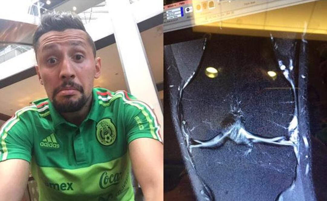 Yasser Corona, baja del Tri por lesión