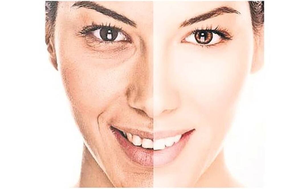 Los péptidos bioactivos de colágeno están diseñados para estimular a determinadas células para producir más de esa proteína. Foto: Archivo/EL UNIVERSAL.