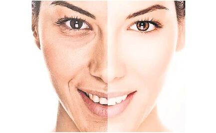 Colágenos, la apuesta para mejorar el cuerpo y cuidar la salud