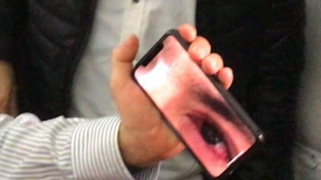 Peña pide "no hacer chisme" sobre su irritación de ojos 