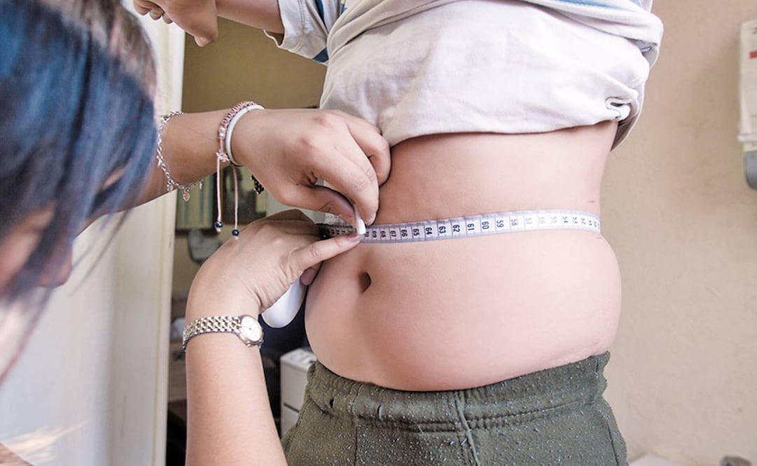 4 millones de niños y niñas de escuelas públicas que han sido revisados tiene obesidad. Foto: EL UNIVERSAL
