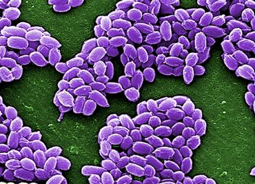 ¿Qué tan mortal es el ántrax? ¿Cuál es su origen? Lo que hay que saber