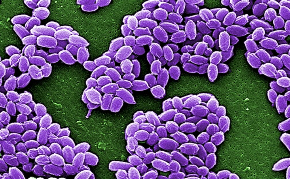 El carbunco o ántrax es ocasionado por la bacteria Bacillus anthracis. Foto: Archivo/EL UNIVERSAL