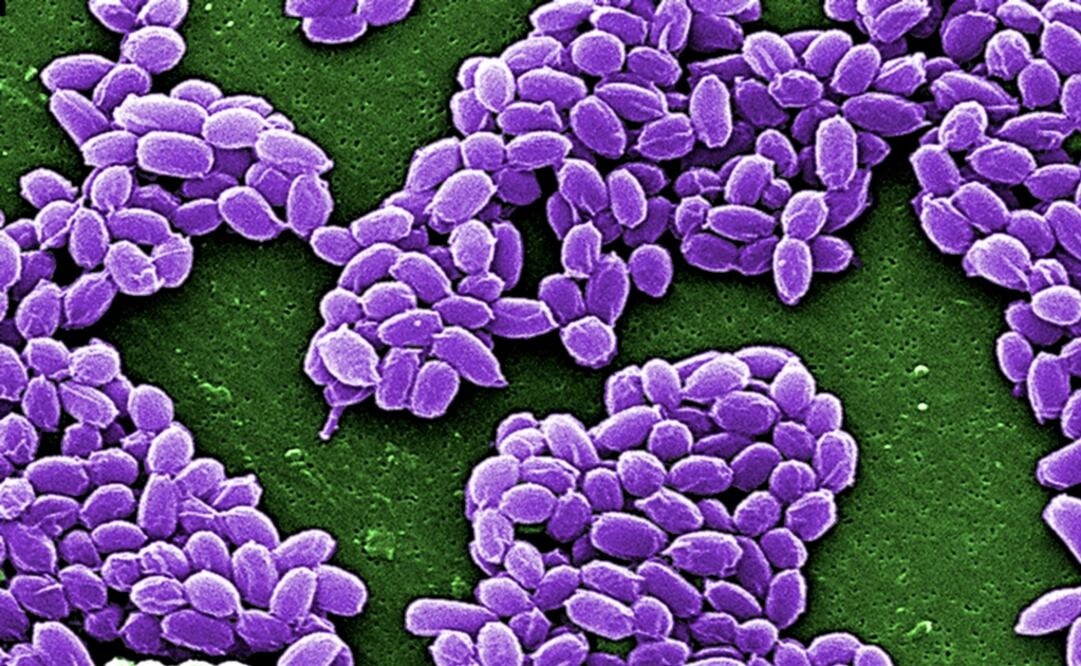 El carbunco o ántrax es ocasionado por la bacteria Bacillus anthracis. (FOTO: Archivo/EL UNIVERSAL)