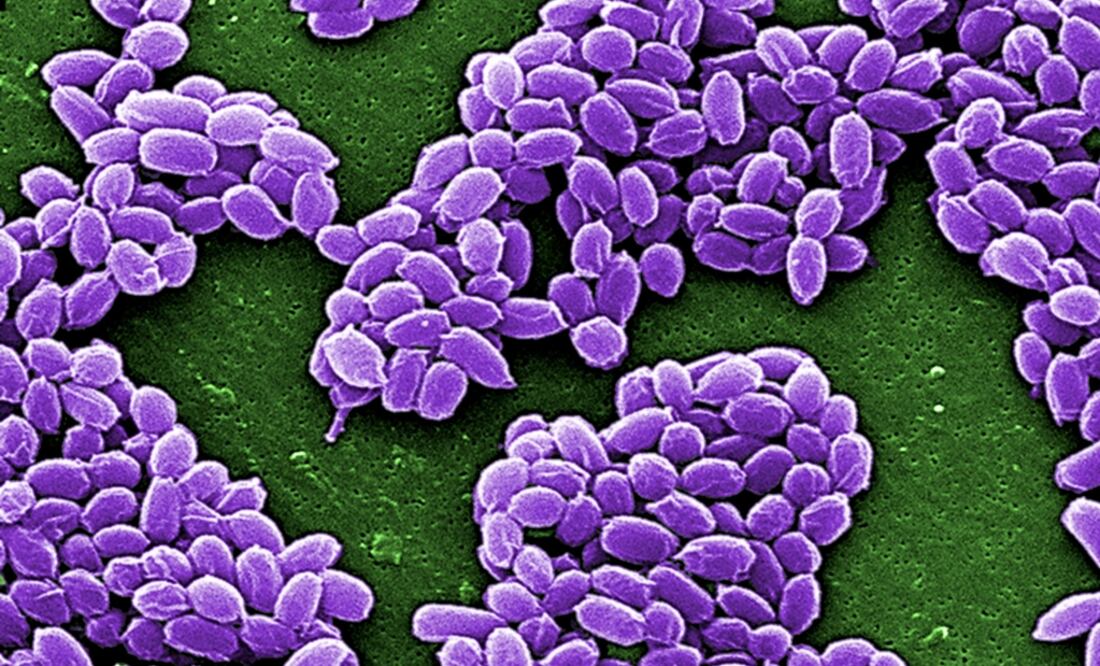 El carbunco o ántrax es ocasionado por la bacteria Bacillus anthracis. (FOTO: Archivo/EL UNIVERSAL)
