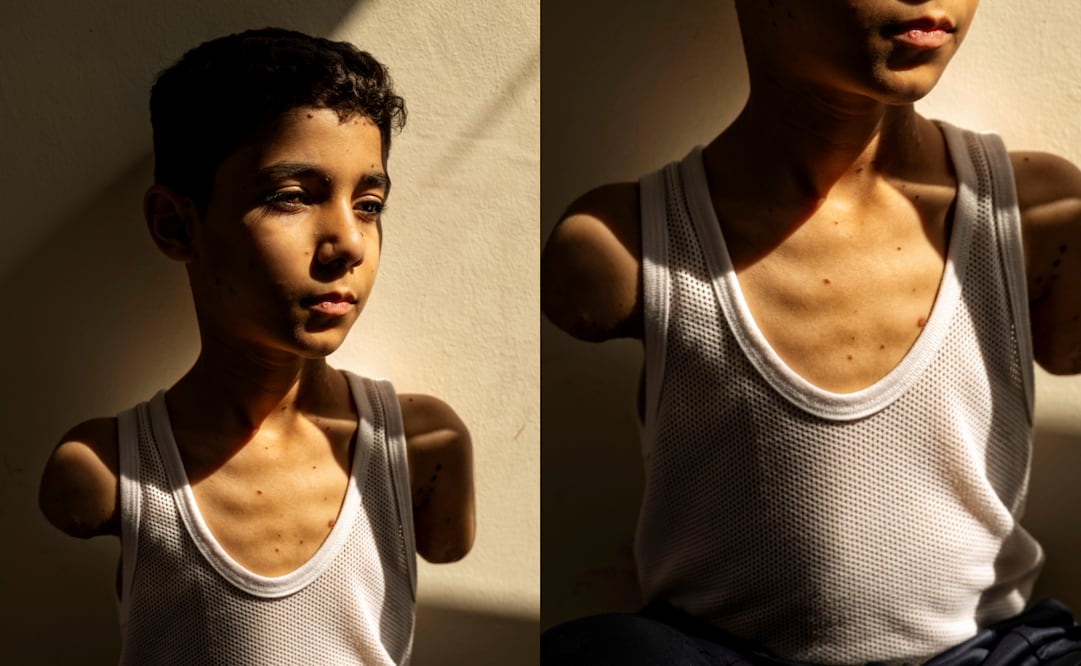 Esta es la historia de Mahmoud Ajjour, quien fue fotografiado por la ganadora del WPP. (17/04/25) Foto: Samar Abu Elouf