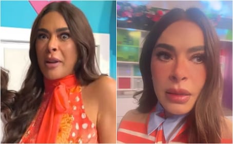 “Es por la inflamación”: Galilea Montijo rompe el silencio sobre su ojo bizco y el rostro hinchado