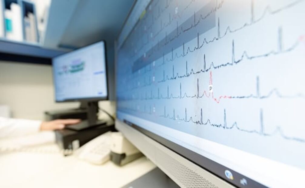 ¿Por qué es importante la prevención cardiometabólica y que cuides tu corazón?