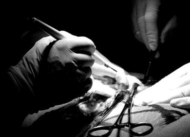 Cae presunta cirujana que practicó mini lipo; su paciente murió tras intestinos perforados