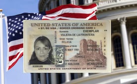 ¿Qué pasa si se vence tu visa láser? Así puedes renovarla sin complicaciones